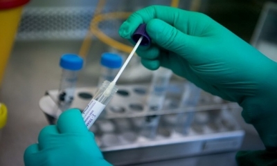 وزارة الصحة: تسجيل 6 وفايات و 260 إصابة جديدة بفيروس كورونا في أسبوع