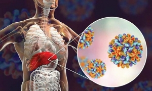 لبنان يسجل 1785 إصابة بمرض التهاب الكبد الفيروسي خلال 8 أشهر