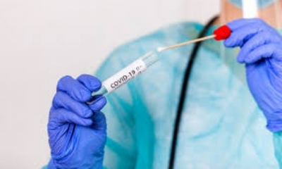 من 27 فيفري إلى 5 مارس :2023  تسجيل 9 وفيات جراء فيروس كورونا و191 إصابة جديدة