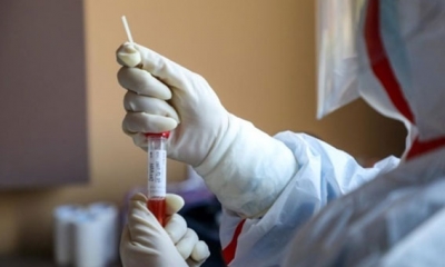 ارتفاع كافة المؤشرات المرتبطة بالوضع الوبائي : تجاوز التحاليل الإيجابية لـ 36 %.. ارتفاع عدد المقيمين في المستشفيات إلى أكثر من ألف شخص