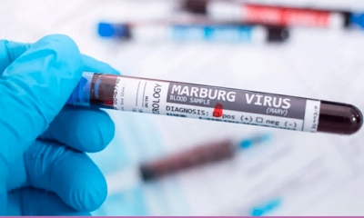 الإمارات توصي بتأجيل السفر إلى الدول التي ينتشر فيها فيروس"ماربورغ"