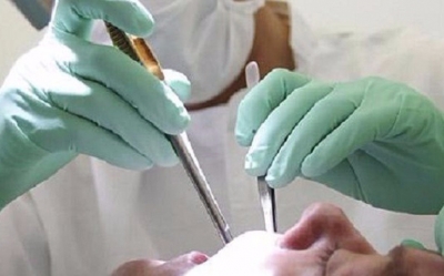 عمادة أطباء الأسنان تصدر عقوبات في حق 6 أطباء منها عقوبتان بالشطب النهائي